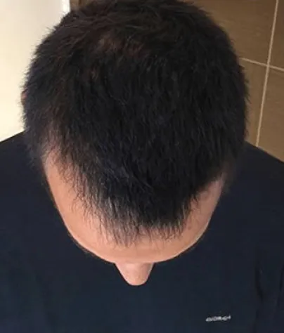 James K. after