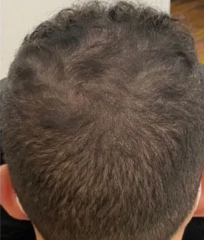 Michael B. after