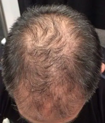 David L. before