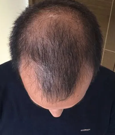 James K. before